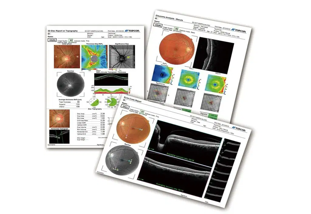 TOPCON Maestro 1 3D OCT-1 Funduskamera Tomographie