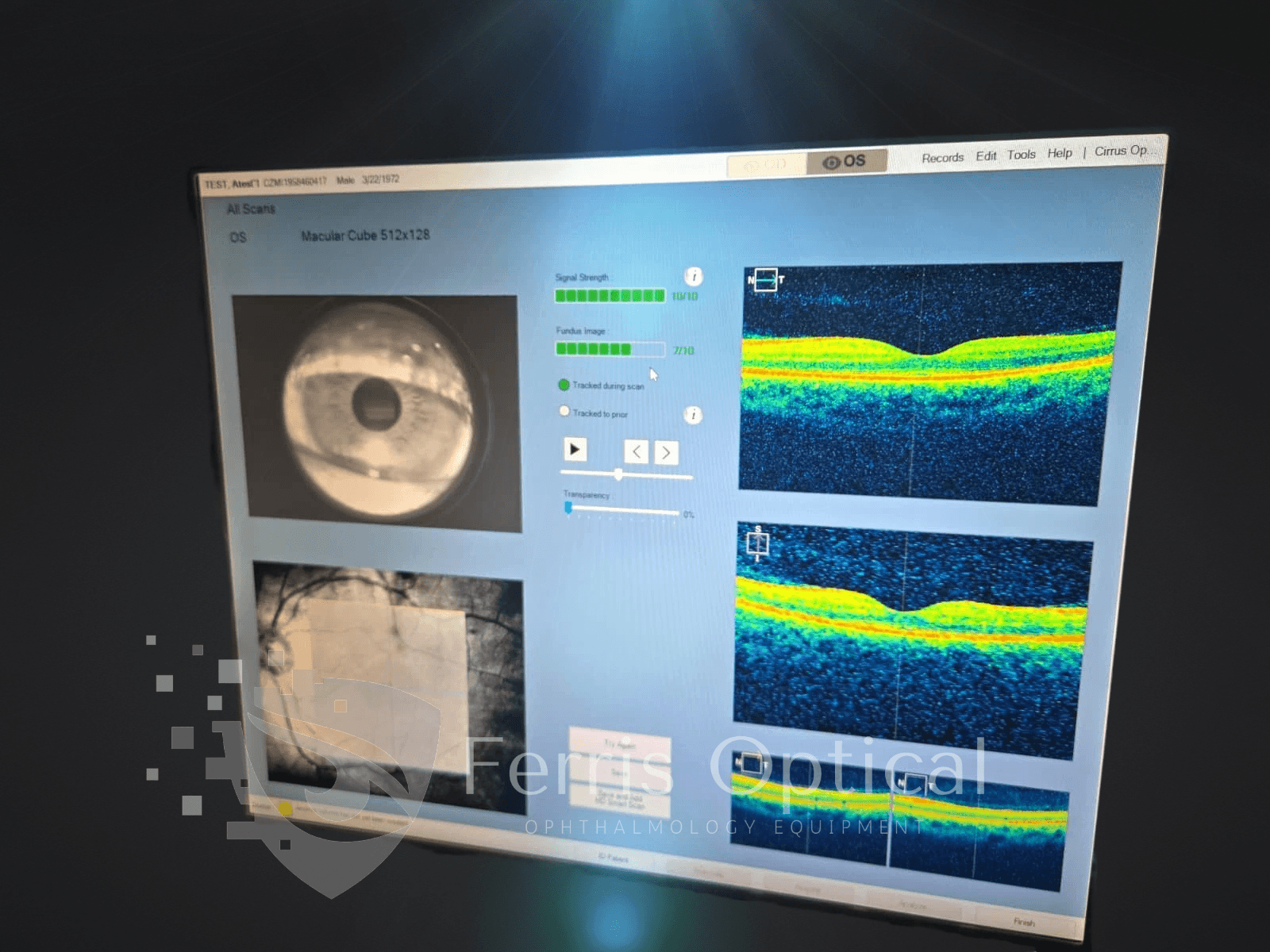 Carl Zeiss Cirrus 5000 HD Optical Coherence Tomography (OCT) - Image 11