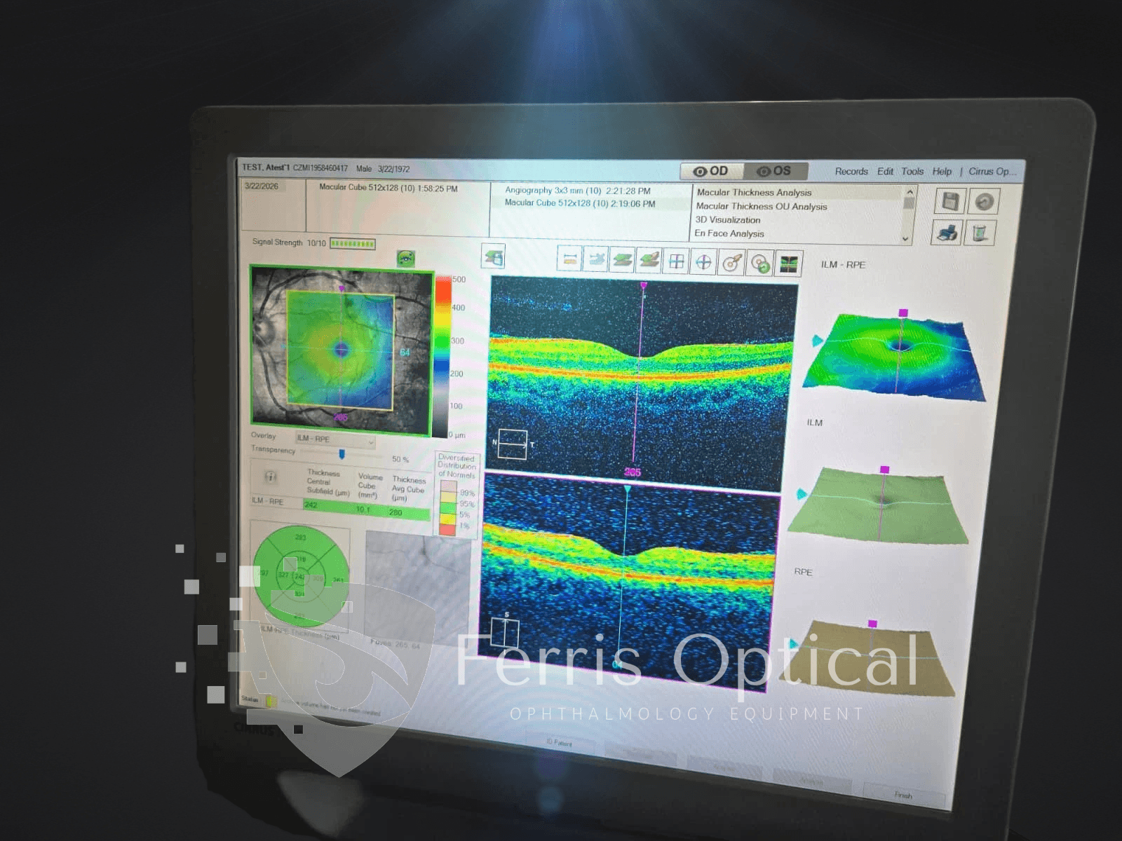 Carl Zeiss Cirrus 5000 HD Optical Coherence Tomography (OCT) - Image 12