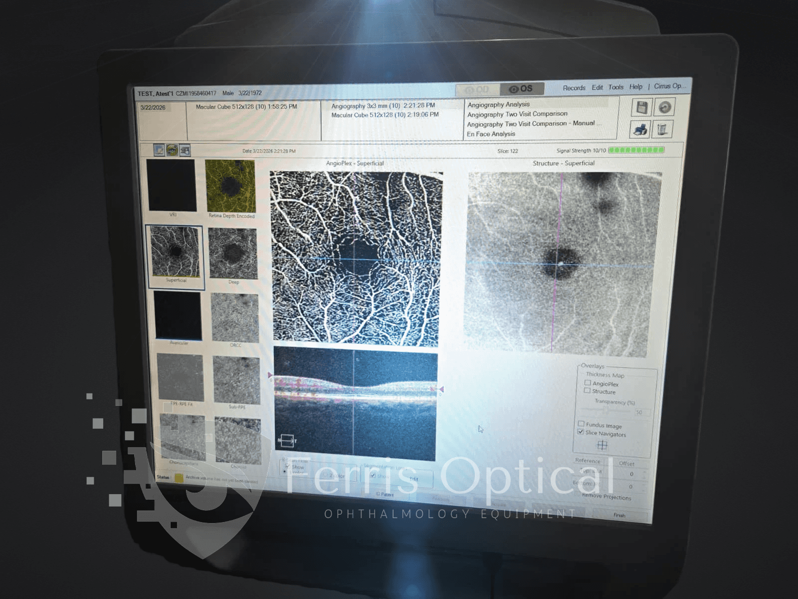 Carl Zeiss Cirrus 5000 HD Optical Coherence Tomography (OCT) - Image 13