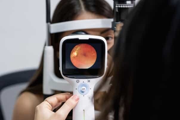 Fundus Camera