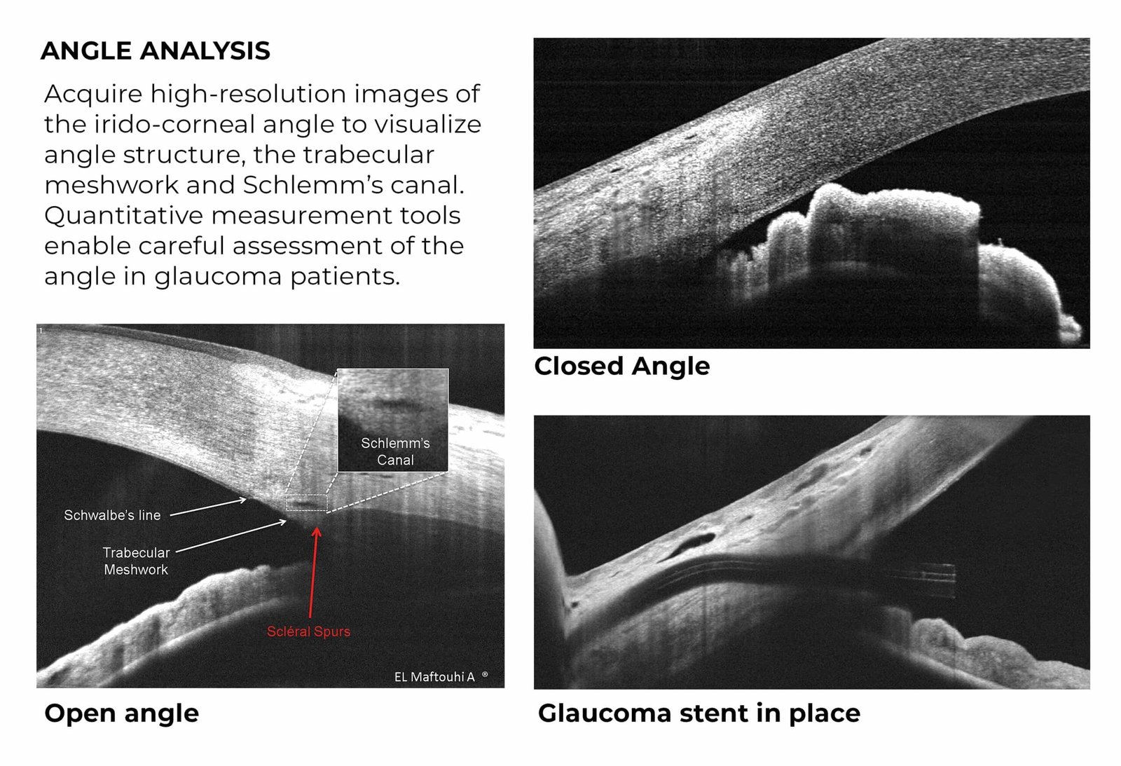 Image 2 Optovue