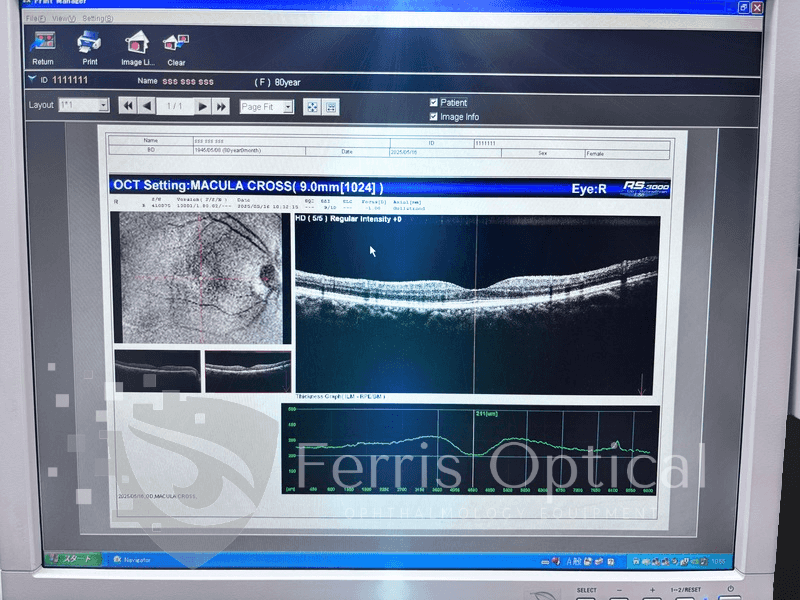 NIDEK RS 3000 Lite OCT Device - Image 18