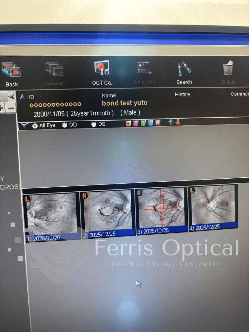 NIDEK RS 3000 Lite OCT Device - Image 9