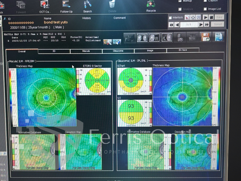 NIDEK RS 3000 Lite OCT Device - Image 10