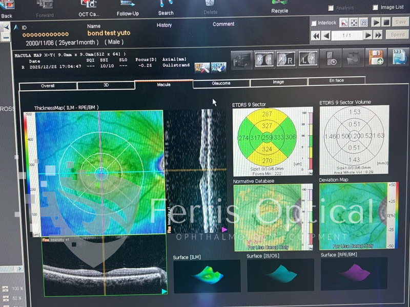 NIDEK RS 3000 Lite OCT Device - Image 11