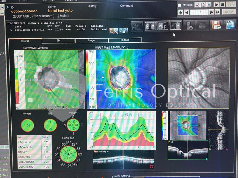 NIDEK RS 3000 Lite OCT Device - Image 12