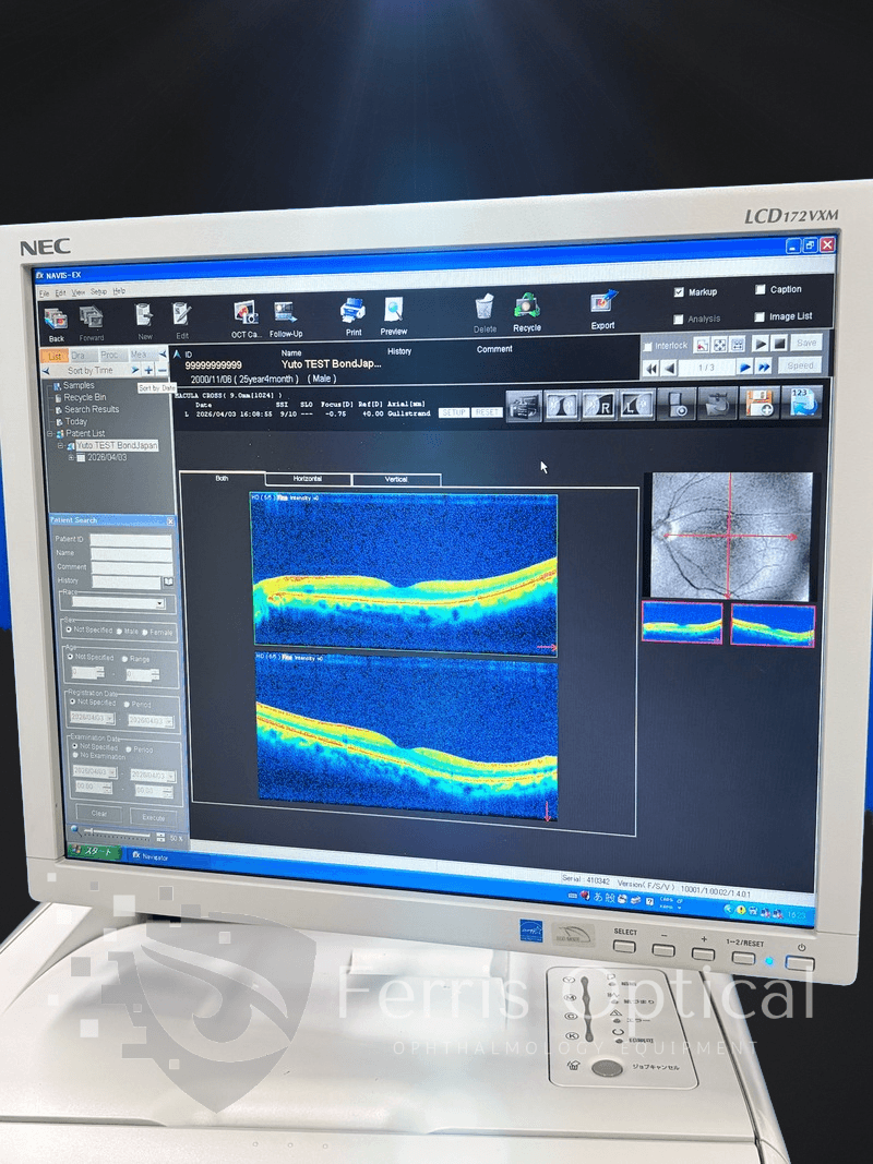 NIDEK RS 3000 Lite OCT Device - Image 6