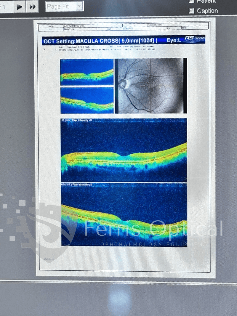 NIDEK RS 3000 Lite OCT Device - Image 7