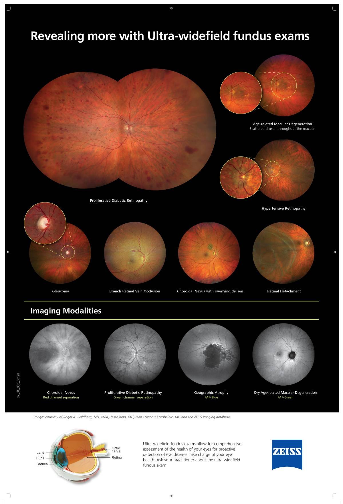 Carl Zeiss CLARUS 500 Ultra-widefield (UWF) Fundus Imaging System