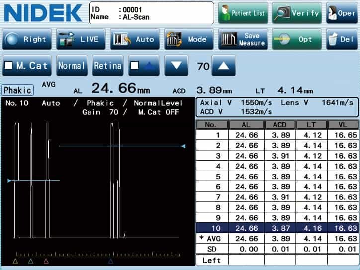 NIDEK AL-Scan